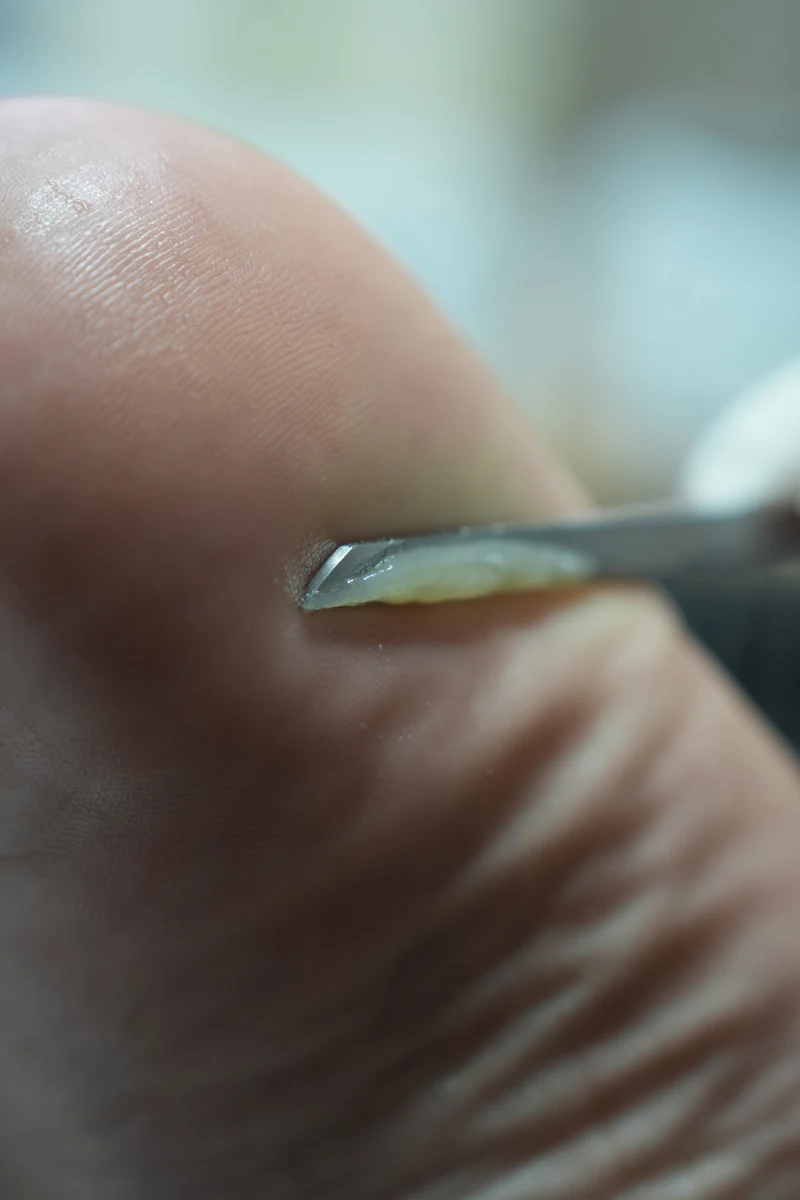 Mascarilla Renovadora de Pies