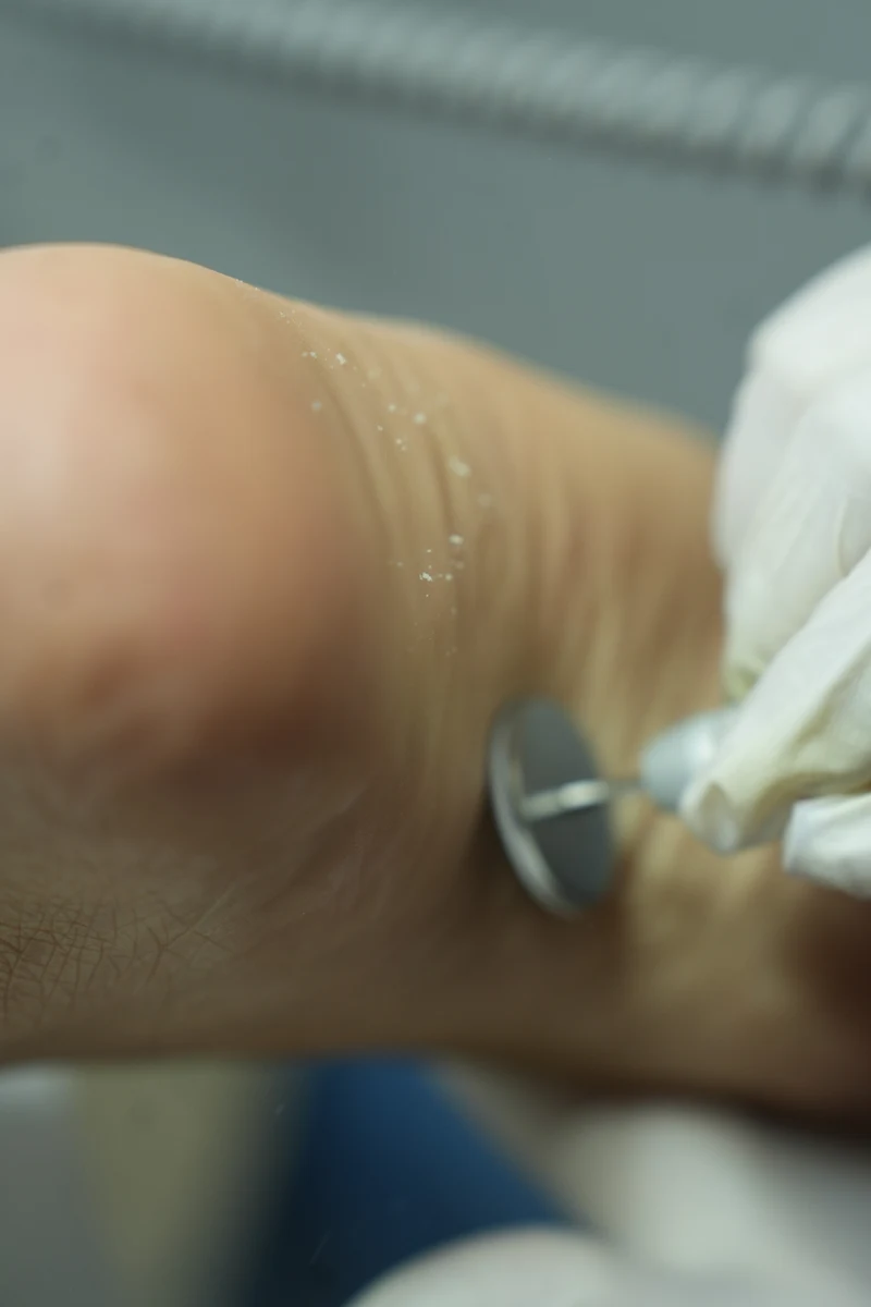 Pedicura en Seco (Técnica Rusa)